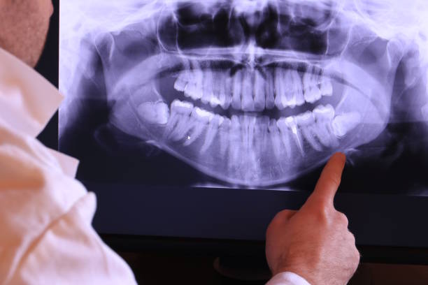Best Emergency Treatment for Toothache in Berlin, MD