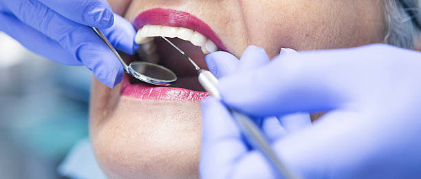 Best Emergency Broken Tooth Repair in Berlin, MD